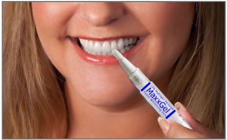 MaxxGel dientes que blanquean la pluma. 12% peróxido de hidrógeno para los dientes que blanquea en el ir! Conjunto de 2 plumas.