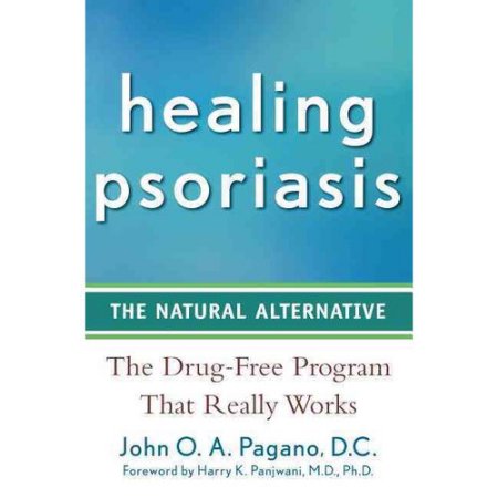 Psoriasis Curación- La alternativa natural