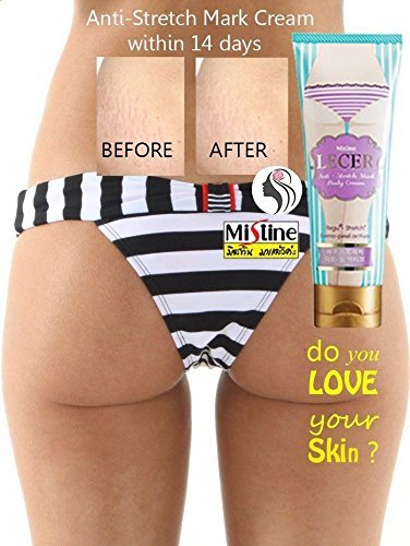 Mistine crema de Lecer Bikini axila codo Anti estrías cuerpo blanqueamiento activo 100 g resultado en 14 días por Miss Siam